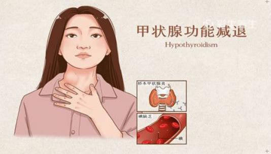 甲減的表現(xiàn)有哪些？