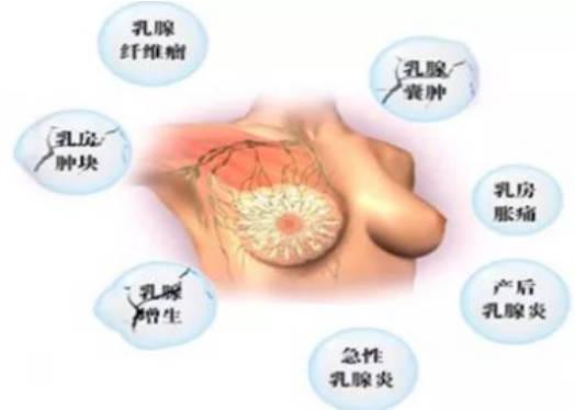 乳腺腫塊治療方式有哪些？