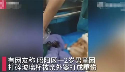 2歲男童因打碎玻璃杯遭外婆暴力毆打，生命岌岌可危