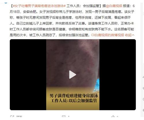 健身房泳池事件曝光：顧客后背滿是疙瘩，引發(fā)衛(wèi)生管理關注
