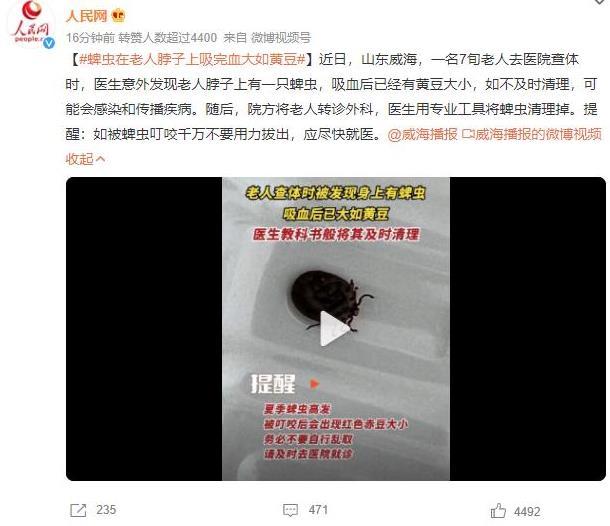山東威海發(fā)現(xiàn)老人脖子上蜱蟲，及時清理避免疾病傳播，掌握蜱蟲清理與預(yù)防方法
