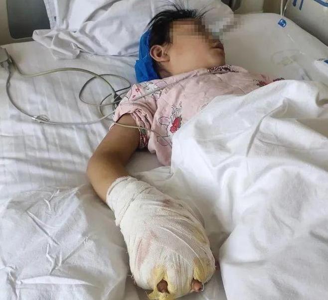 甘肅女童遭繼母虐待致殘，父親堅(jiān)決追究，警方已介入調(diào)查